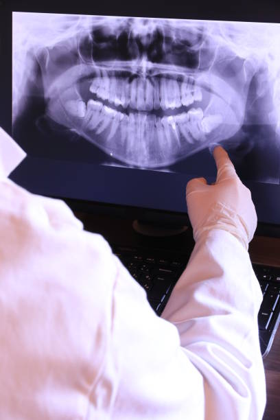 Best Emergency Tooth Extraction in Wood Ridge, NJ