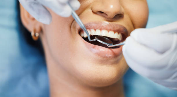 Best Emergency Wisdom Teeth Removal in Wood Ridge, NJ